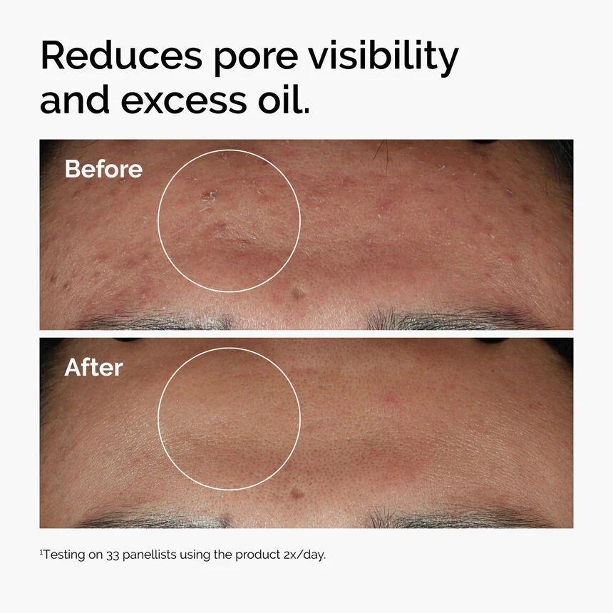 Niacinamide 10% + Zinc 1% | THE ORDINARY - image 4